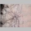 Neuronas Golgi 04.jpg